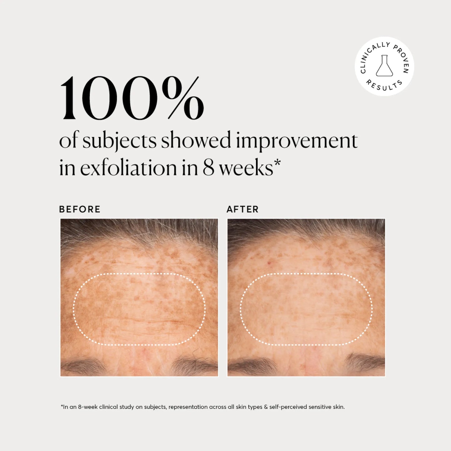 bha-liquid-exfoliant-2-w4 NATR-10027-Alt-Images-BHA-Liquid-Exfoliant-2_-03.webp